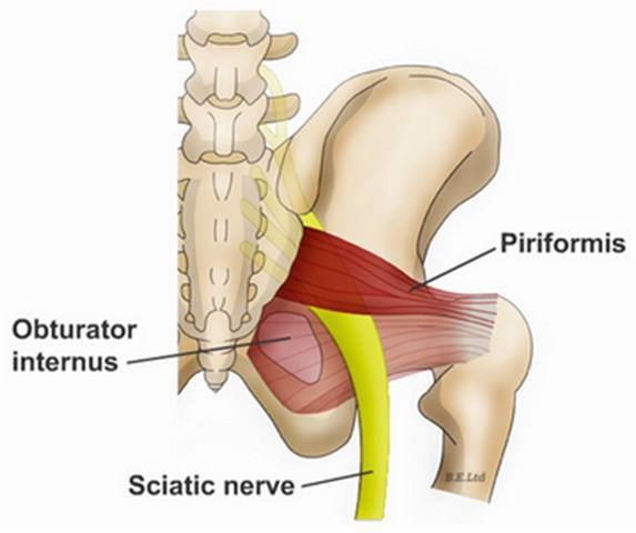 Piriformis Syndrome FAQs, Hip and Pelvis, Doctor Articles